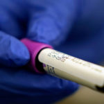 Germ warfare researchers design ‘game-changer’ coronavirus test