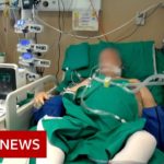 Coronavirus: What happens in an intensive care unit? – BBC News