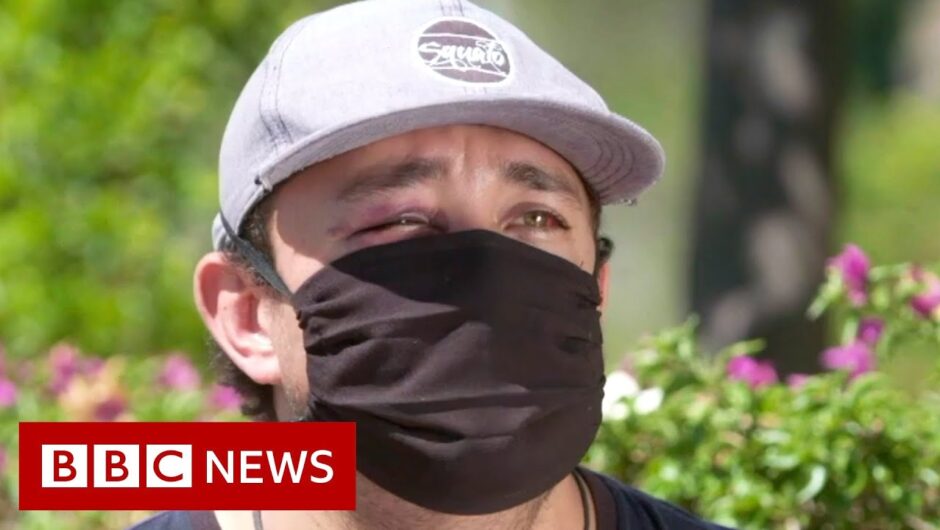 Coronavirus: Mexico healthcare workers attacked – BBC News