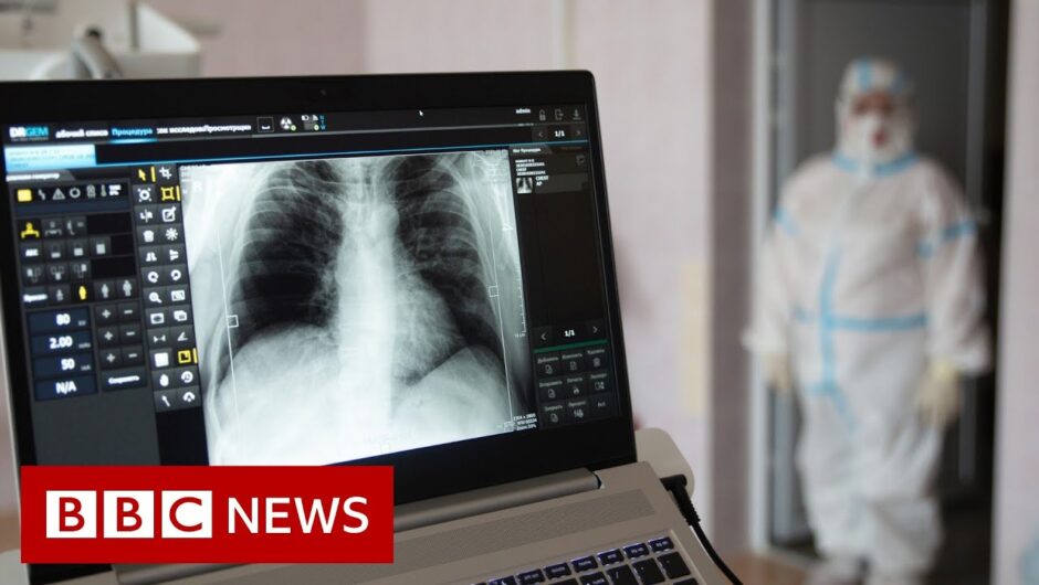 Some long Covid patients may have hidden damage to their lungs – BBC News